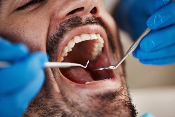 Best Broken Tooth Emergency  in Delevan, NY