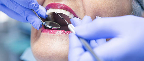 Best Urgent Tooth Repair  in Delevan, NY